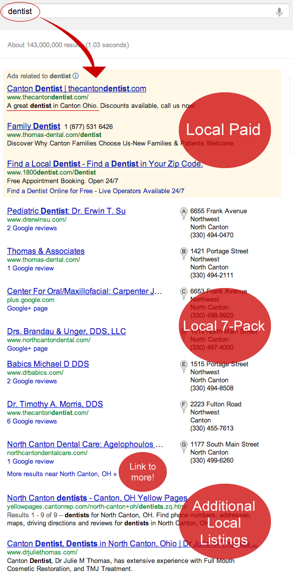 local-Google-listings